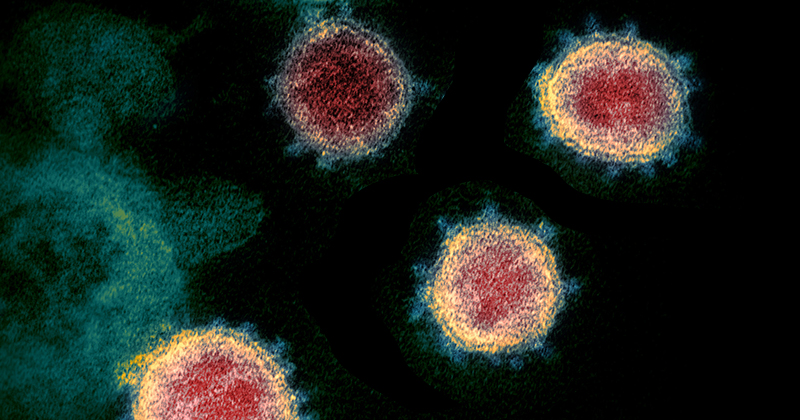 20200227_02_coronavirus_1.jpg